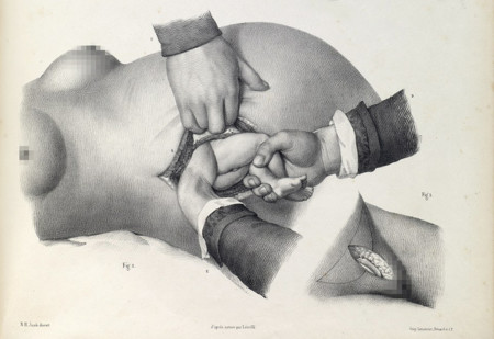 Cesareasiglo192