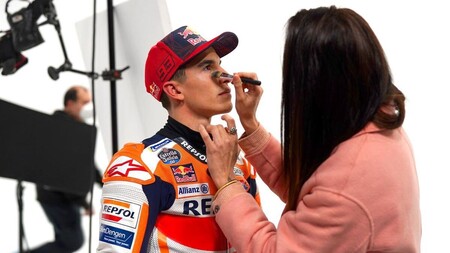 Marc Márquez progresa de su lesión tras otra inspección médica pero no hay fecha para su vuelta a MotoGP
