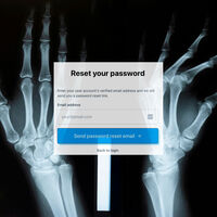 Implantarse un chip en la mano para hacer trucos de magia sonaba espectacular. Hasta que olvidó la contraseña