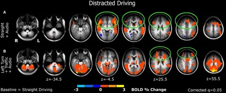 fMRI study 03 Estudio de la actividad cerebral durante la conducción
