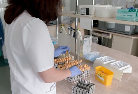 Qué es y para qué sirve la prueba de hemoglobina glicosilada