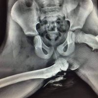 “Si tu pasajero lo hace, quizá deberías dejar de conducir y enseñarle esto”: la imagen que demuestra por qué nunca se debe ir en coche con los pies en el salpicadero