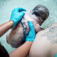 Bebés nacidos con un nudo en el cordón umbilical