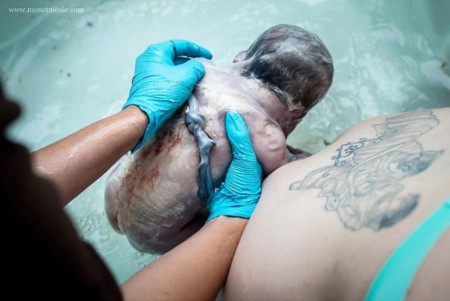 Bebés nacidos con un nudo en el cordón umbilical