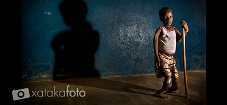 Antonio Aragón, un fotógrafo con un 'par' de motivos para cambiar el mundo