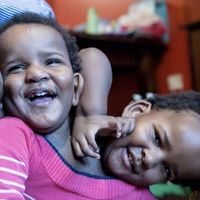 Un padre de siamesas ante una separación imposible: prefiere que "sigan juntas el tiempo que les quede" y no elegir que una muera