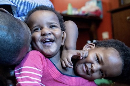Un padre de siamesas ante una separación imposible: prefiere que "sigan juntas el tiempo que les quede" y no elegir que una muera