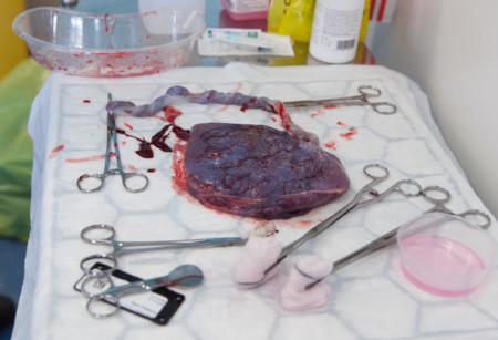 Placenta humana
