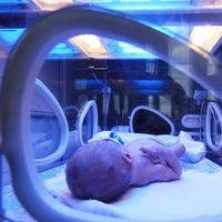 La ictericia en recién nacidos podría ser un sistema de defensa evolutivo contra la muerte por sepsis