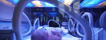 La ictericia en recién nacidos podría ser un sistema de defensa evolutivo contra la muerte por sepsis