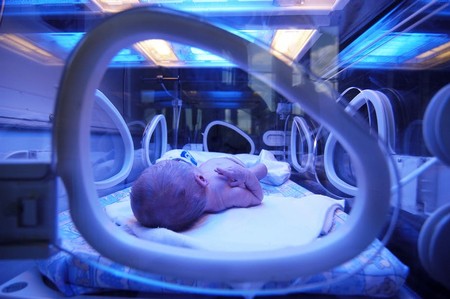 La ictericia en recién nacidos podría ser un sistema de defensa evolutivo contra la muerte por sepsis