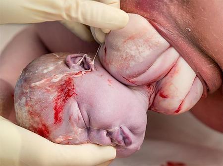 650 1000 Facebookcensura