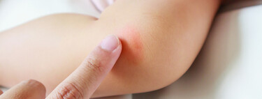 Picaduras de mosquitos en bebés: cómo protegerlos y qué repelentes elegir  