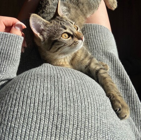 toxoplasmosis