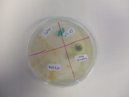 Las parejas comparten incluso sus bacterias