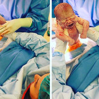 Las increíbles fotos de una cesárea en las que la madre saca a su cuarto bebé con sus propias manos