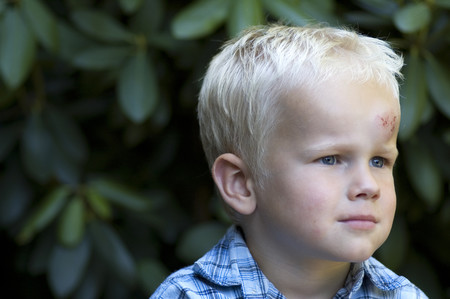 Golpe leve cabeza niños