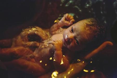 Desaconsejan el parto en el agua por riesgo para la salud de los recién nacidos