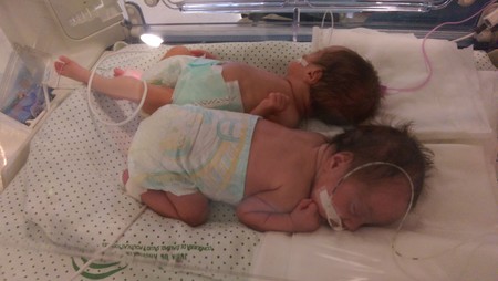 gemelas prematuras