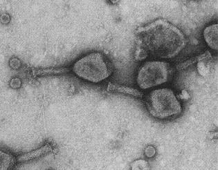 Enzibióticos, el arma definitiva contra las bacterias
