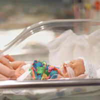 Bebés extremadamente prematuros: el 96% de los nacidos antes de la semana 24 sufre algún trastorno 