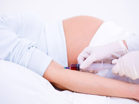 Tener diabetes en el embarazo podría aumentar el riesgo de que los hijos padezcan enfermedades cardiacas antes de los 35 años