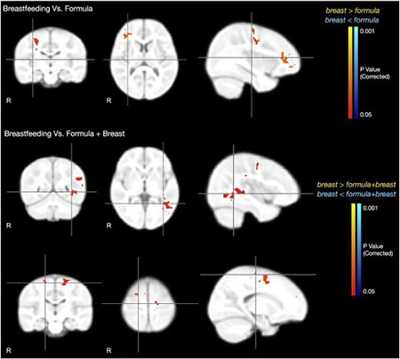 Diferencias entre cerebros según alimentación
