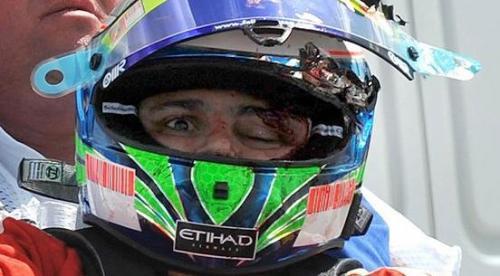 massa.jpg