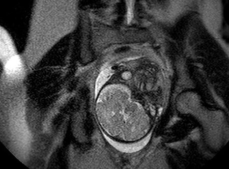 parto-resonancia3.jpg