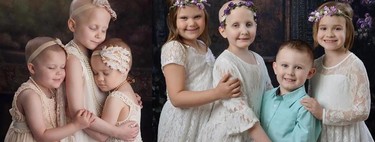 Cuatro años después, tres niñas y un niño recrean una foto viral que representa la lucha contra el cáncer 
