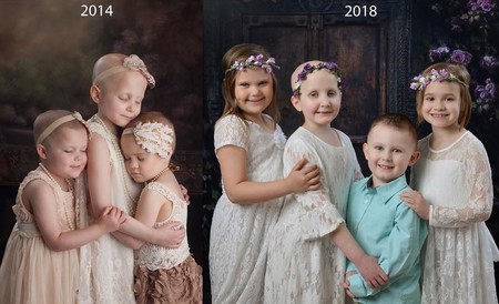 Cuatro años después, tres niñas y un niño recrean una foto viral que representa la lucha contra el cáncer