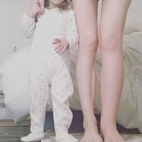 Una extraña condición dejó su pierna izquierda al doble de su tamaño tras el embarazo: ¿qué es un linfedema?