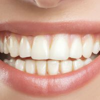 Japón está más cerca de hacer realidad el sueño de los dentistas: un medicamento para nazcan dientes nuevos 