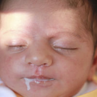 Mi bebé regurgita, ¿qué puedo hacer?