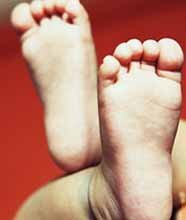 Los niños obesos tienen pies más anchos y más largos