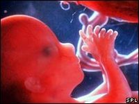 Las células maternas pueden sanar la diabetes de tipo 1 de su hijo