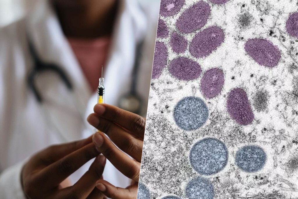 Casi el 50% de quienes que se vacunaron contra la viruela del mono no completaron su pauta. Sanidad acaba de enviar un recordatorio