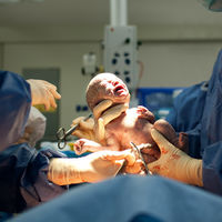 Una jueza autoriza a los médicos a realizar una cesárea, a pesar de la oposición de la madre