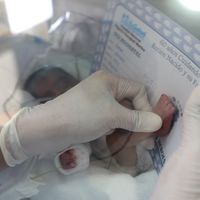 Jorge, el bebé prematuro de solo 580 gramos que ha vencido al Covid-19