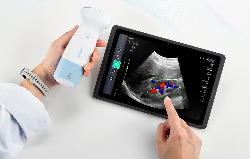 Este invento de Asus permite hacer ecografías directamente desde el móvil 