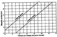 La efectividad del partograma a debate