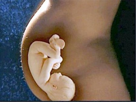 La embarazada desmemoriada: efectos de la oxitocina en el parto