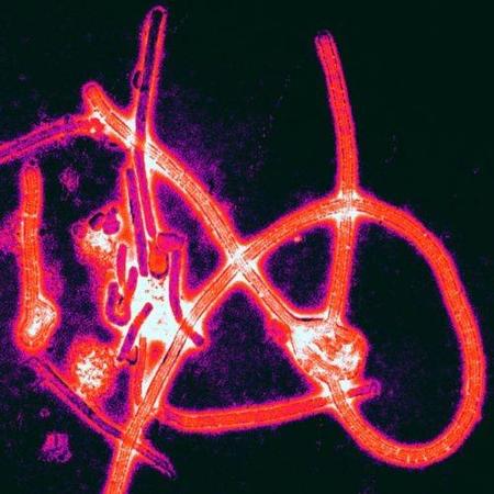 Todo lo que necesitas saber sobre el ébola y su contagio en 10 puntos