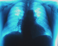 Consideraciones en el análisis económico-financiero de empresas