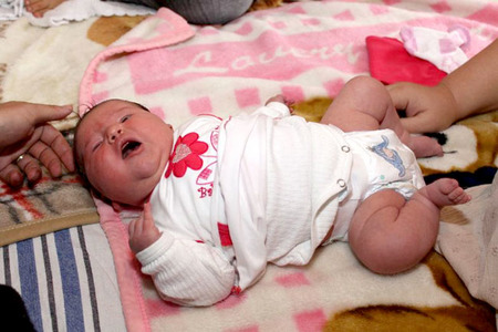 Bebé macrosómico en Hungría 2