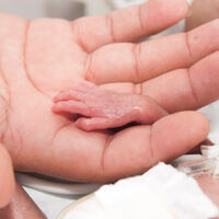 Nació con 393 gramos y 19 centímetros y ha salido adelante: es el bebé gran prematuro más pequeño de España