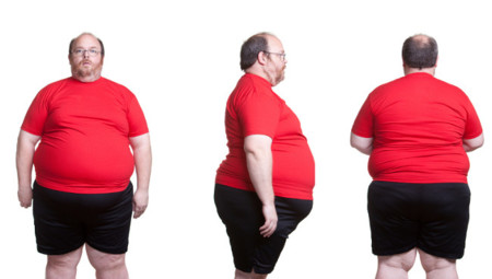 Estudio revela 6 tipos diferentes de personas con obesidad