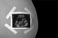 Estoy embarazada: ¿Qué podría hacer daño a mi bebé?