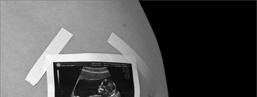 Estoy embarazada: ¿Qué podría hacer daño a mi bebé?