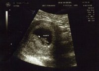 Conocer el sexo del bebé en la primera ecografía